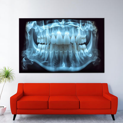 Blue Dental X-ray Tooth Anatomy Canvas Print