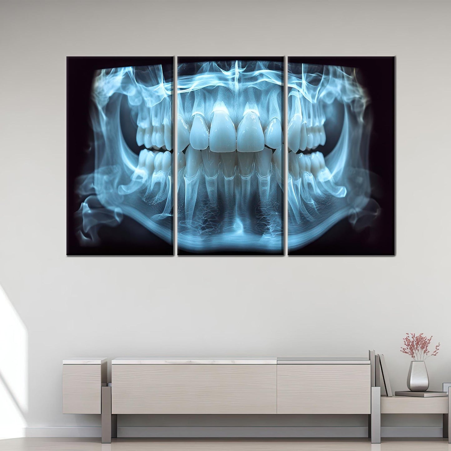 Blue Dental X-ray Tooth Anatomy Canvas Print