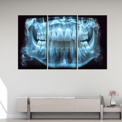 Blue Dental X-ray Tooth Anatomy Canvas Print