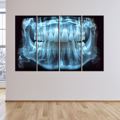Blue Dental X-ray Tooth Anatomy Canvas Print