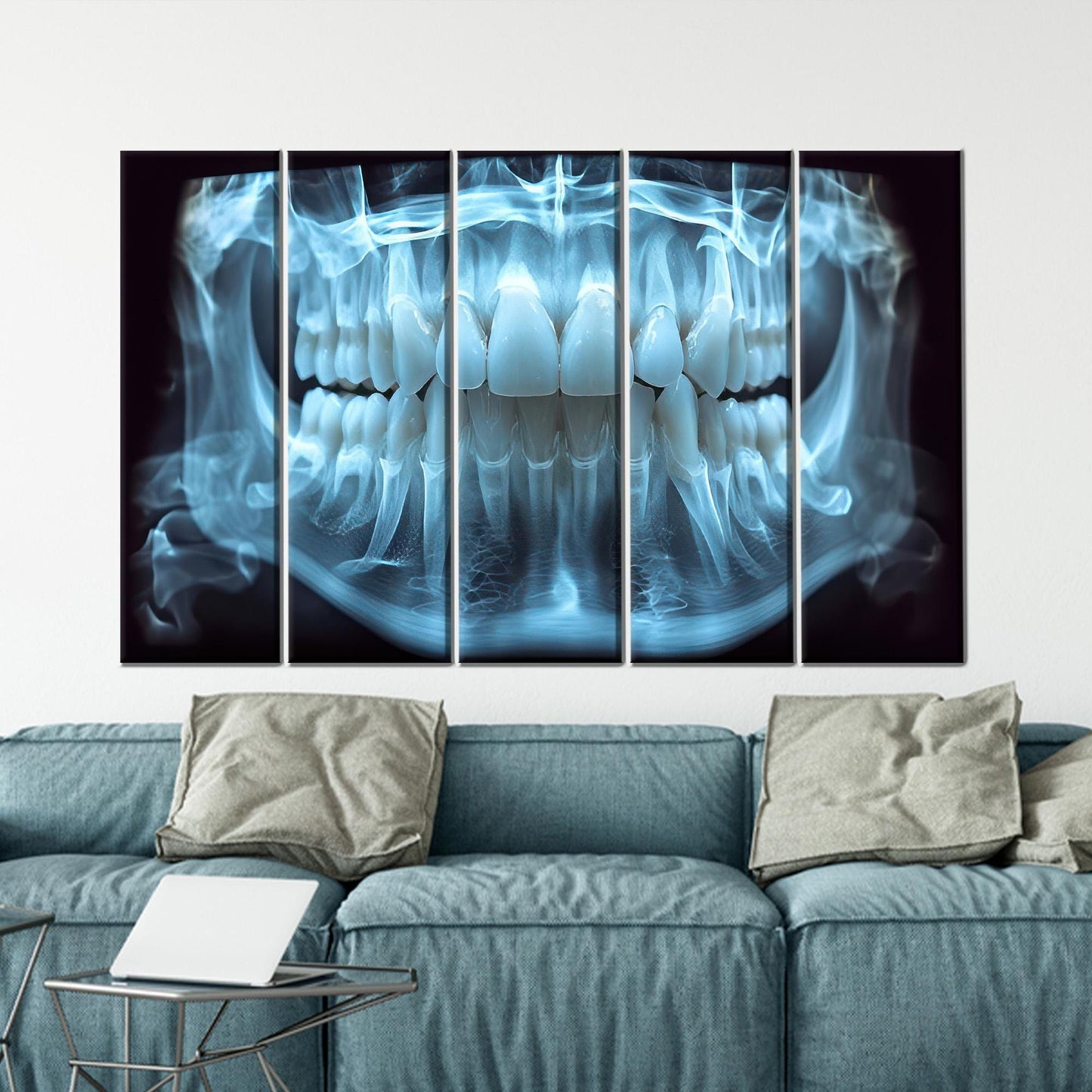 Blue Dental X-ray Tooth Anatomy Canvas Print