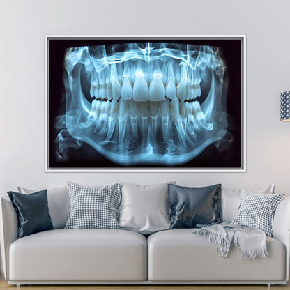 Blue Dental X-ray Tooth Anatomy Canvas Print