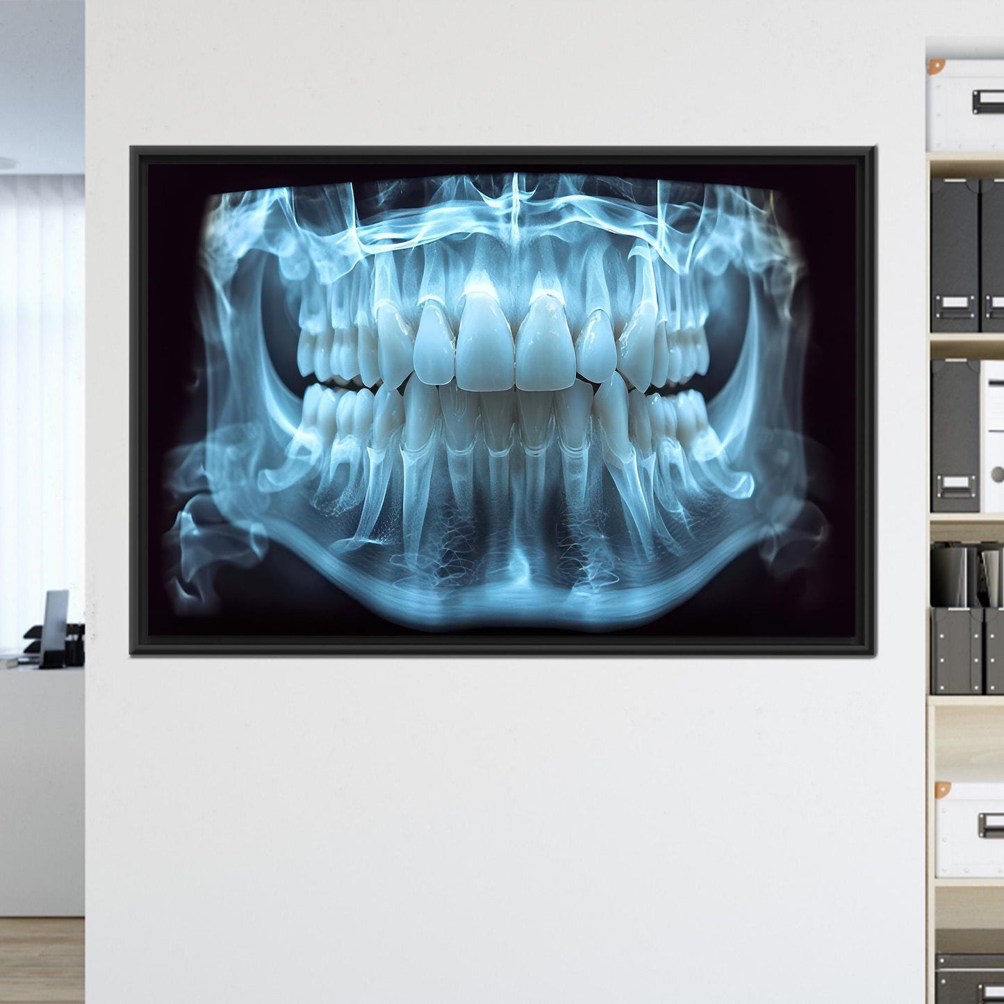 Blue Dental X-ray Tooth Anatomy Canvas Print